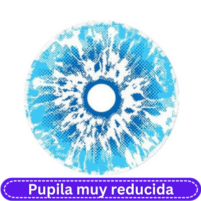 17.0 mm White Walker